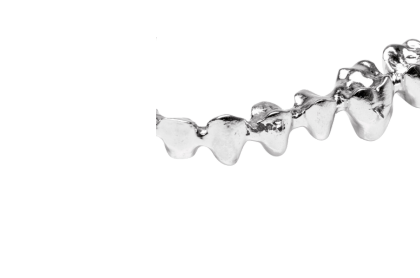 Crowns & bridges